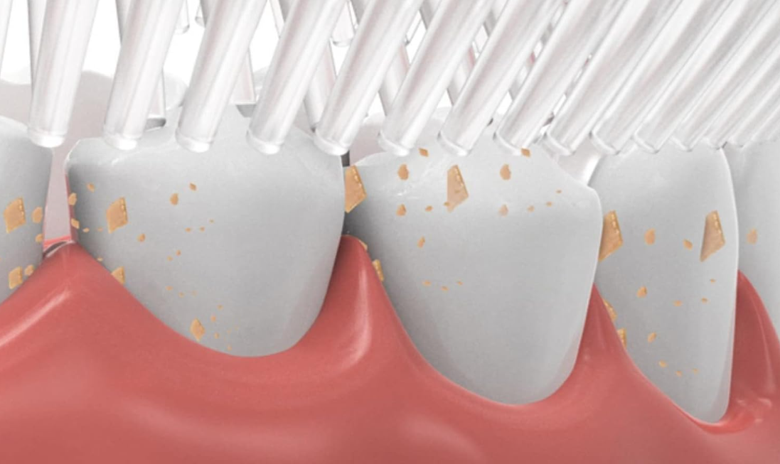 🦷 DJEČIJA U-SHAPE ČETKICA ZA ZUBE – ZABAVNO I LAKŠE PRANJE ZUBIĆA! 🌈✨