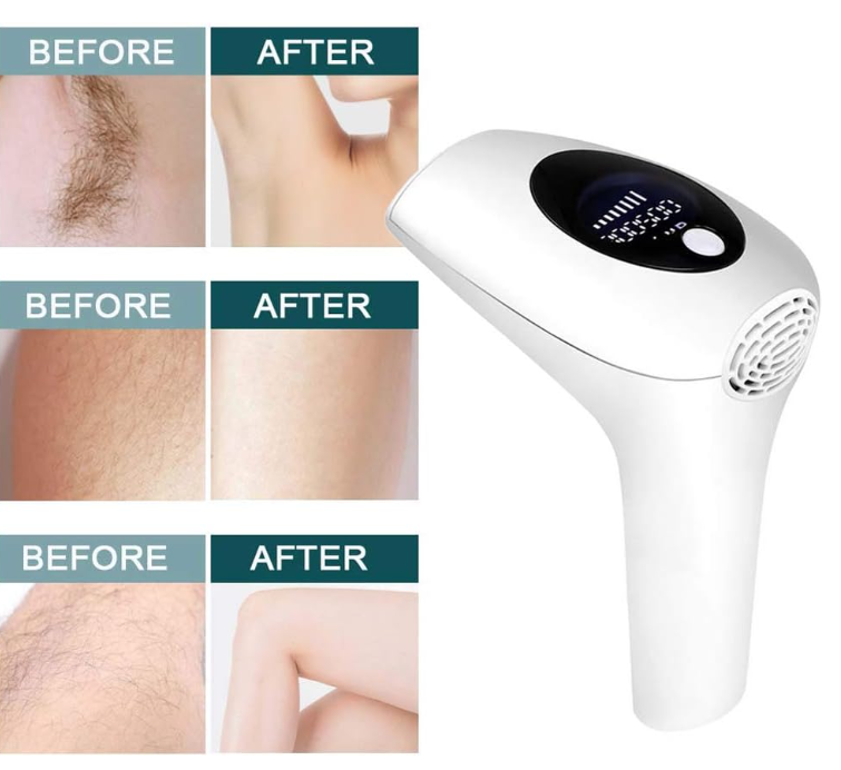 🔥 PROFESIONALNI IPL FOTOEPILATOR – 900.000 BLJESKOVA, 8 NIVOA JAČINE I DUGOTRAJNO SMANJENJE DLAČICA! ✨