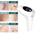 🔥 PROFESIONALNI IPL FOTOEPILATOR – 900.000 BLJESKOVA, 8 NIVOA JAČINE I DUGOTRAJNO SMANJENJE DLAČICA! ✨