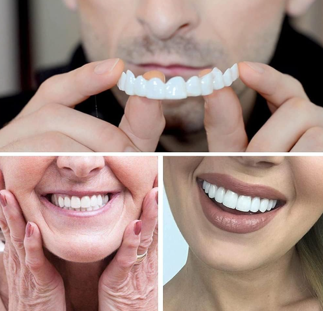 😁 INSTANT PERFECT SMILE – KOZMETIČKE NAVLAKE ZA ZUBE 2U1, GORNJA I DONJA VILICA! ✨🦷