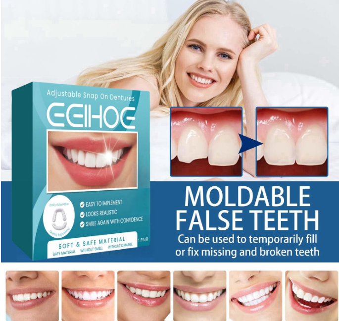 😁 SNAP-ON VENEERS – PODESIVE KOZMETIČKE NAVLAKE ZA ZUBE, GORNJA I DONJA VILICA!