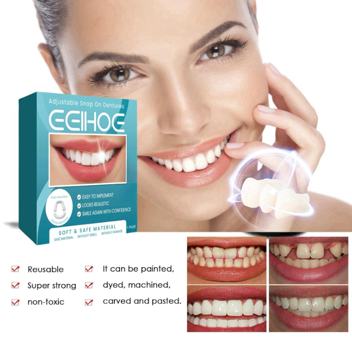 😁 SNAP-ON VENEERS – PODESIVE KOZMETIČKE NAVLAKE ZA ZUBE, GORNJA I DONJA VILICA!