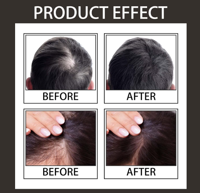 🔥 INSTANT PRAH ZA ZGUŠNJAVANJE KOSE – PREKRIJTE RIJETKA MJESTA I ĆELAVE DIJELOVE ZA SAMO NEKOLIKO SEKUNDI! 💇♂️💇♀️