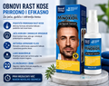 🌿 PREMIUM PREPARAT ZA RAST I JAČANJE KOSE – PROTIV OPADANJA I ZA GUŠĆU, JAČU I ZDRAVIJU KOSU! 💆♀️✨