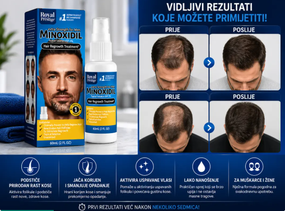 🌿 PREMIUM PREPARAT ZA RAST I JAČANJE KOSE – PROTIV OPADANJA I ZA GUŠĆU, JAČU I ZDRAVIJU KOSU! 💆♀️✨