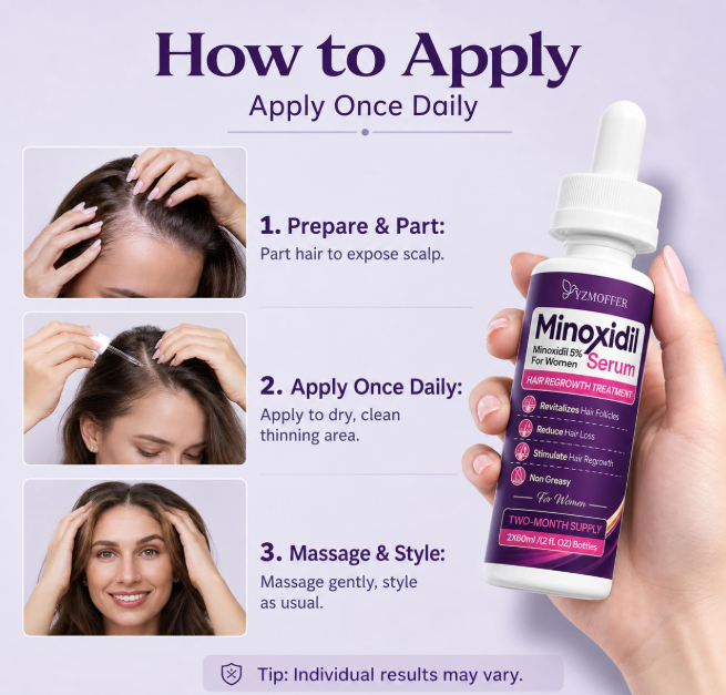 🌸 MINOXIDIL 5% – TRETMAN ZA PONOVNI RAST KOSE KOD ŽENA! 💆♀️✨
