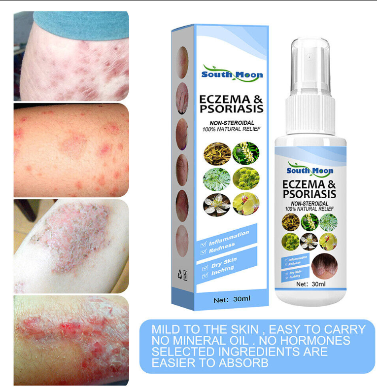 ANTIBAKTERIJSKI SPREJ ZA NJEGU KOŽE – INTENZIVNA HIDRATACIJA I NJEGA KOŽE SKLONE PSORIJAZI!