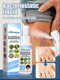 ANTIBAKTERIJSKI SPREJ ZA NJEGU KOŽE – INTENZIVNA HIDRATACIJA I NJEGA KOŽE SKLONE PSORIJAZI!