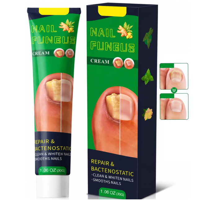 🍄 KREMA PROTIV GLJIVICA NA NOKTIMA – ZA NOKTE NA RUKAMA I NOGAMA | BILJNA FORMULA ZA OŠTEĆENE, ZADEBLJALE I PROMIJENJENE NOKTE!