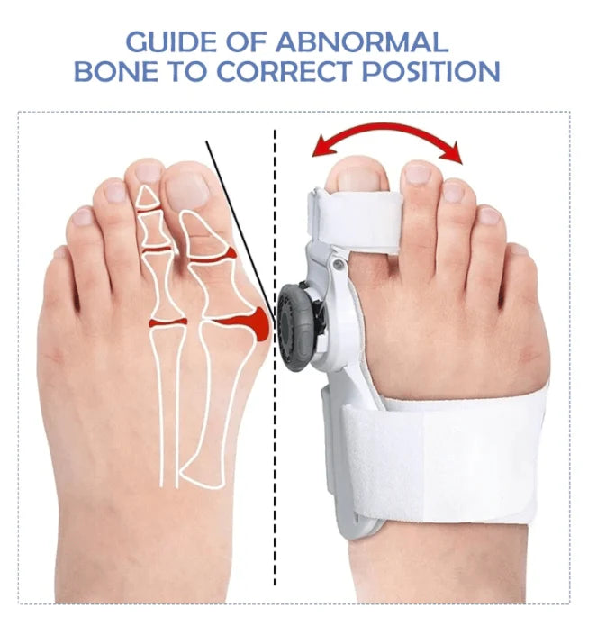 Profesionalni ispravljač Korektor za Nožne Prste